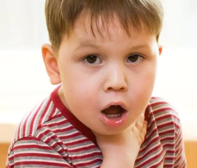 What is the danger of papillomas in the throat in children?