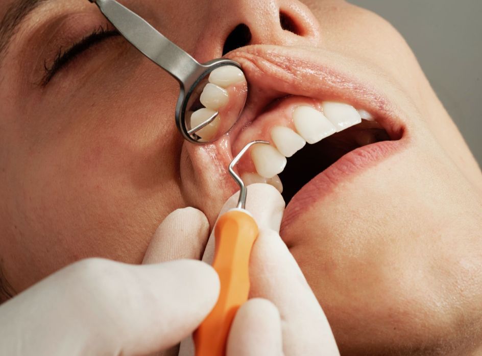 Dental restoration: Restoring your smile and health