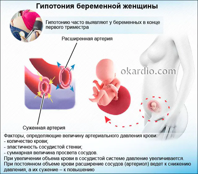 Hypotonie während der Schwangerschaft