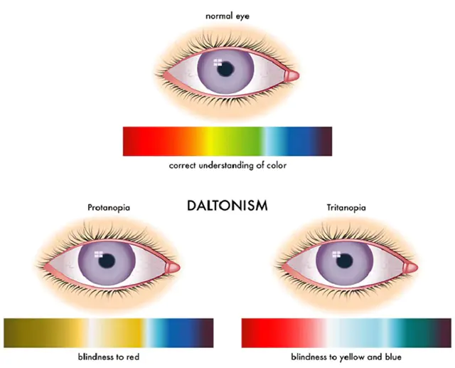 Renk körlüğü türleri