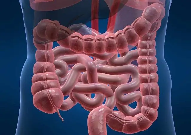 Isquemia intestinal