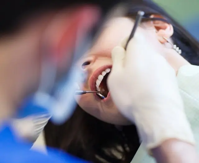 Besøg hos tandlægen for oral papilloma