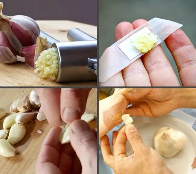 Cara menggunakan bawang putih untuk papiloma