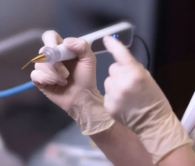 Laserové odstranění papilomů na prstech
