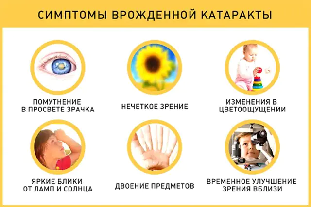Symptoms of cataracts in children