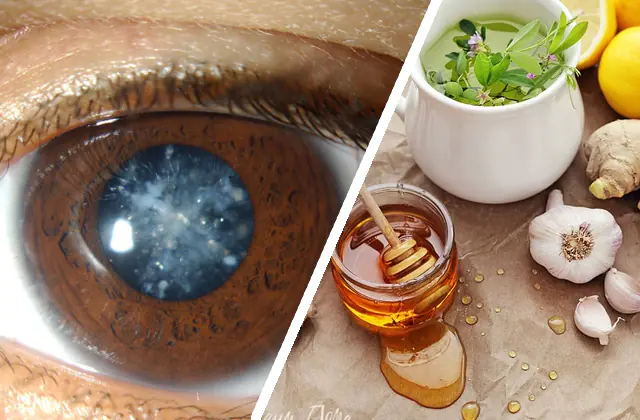 Treatment of cataracts with folk remedies
