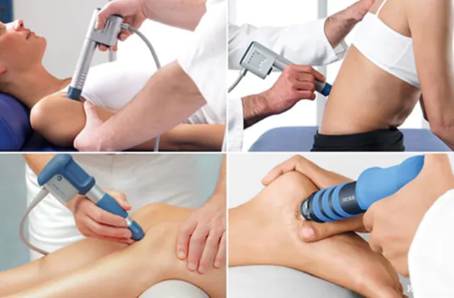 Shock wave therapy in the treatment of osteophytes