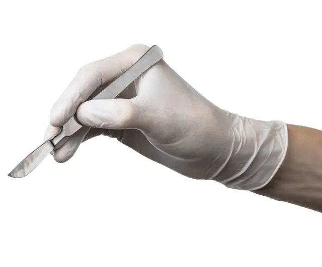 Verwijdering van een puntig papilloma met een chirurgische scalpel