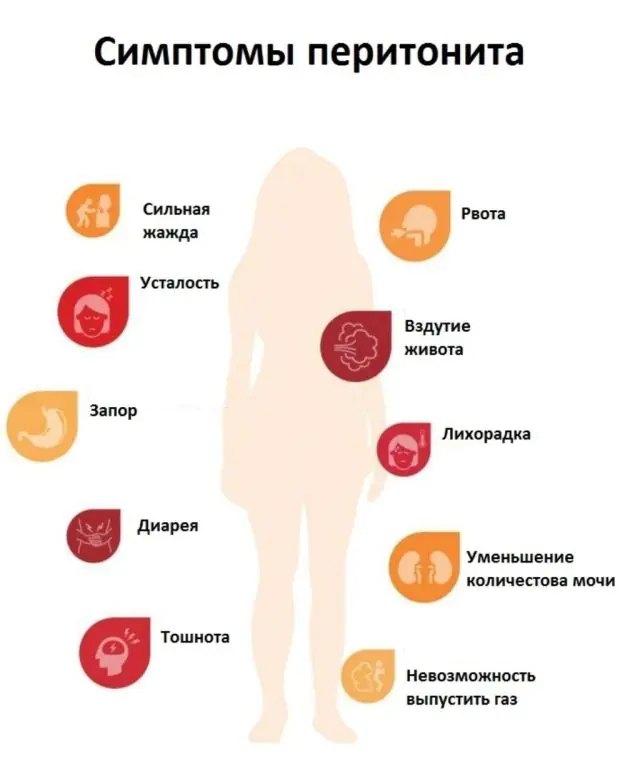 Peritonitin simptomları