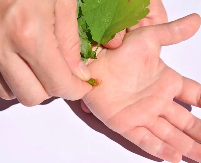 Celandine against flat papillomas on the hands