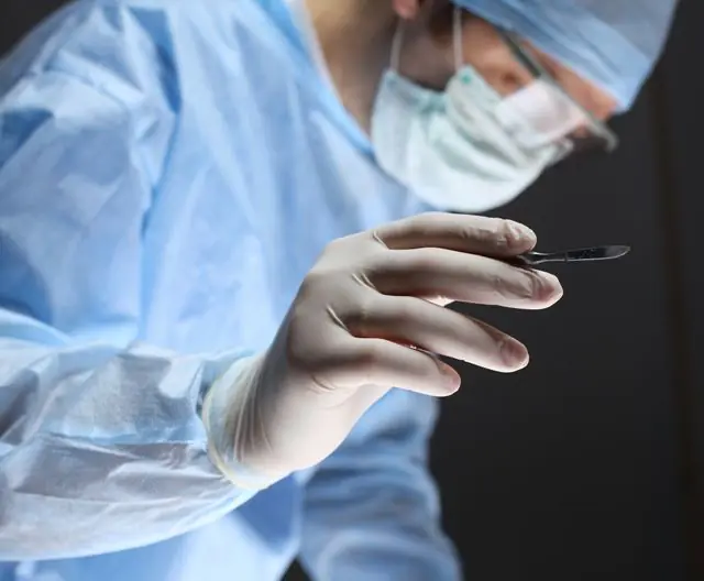 Remoção cirúrgica de papilomas nas amígdalas em uma criança
