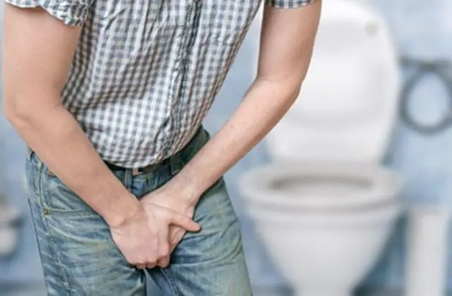 Difficulty urinating due to papillomas in the urethra
