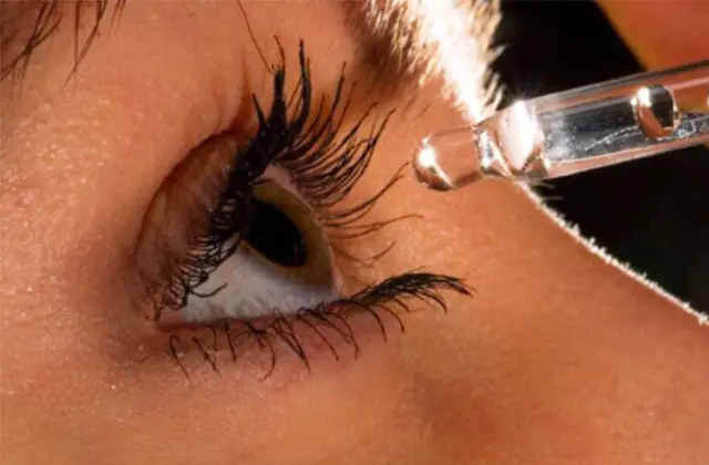 Förebyggande av pterygium i ögat
