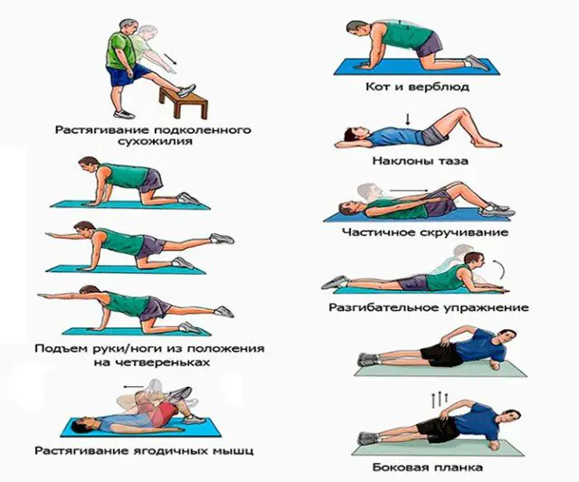Therapeutic exercises for radiculopathy