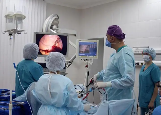 Salpenjit için laparoskopi