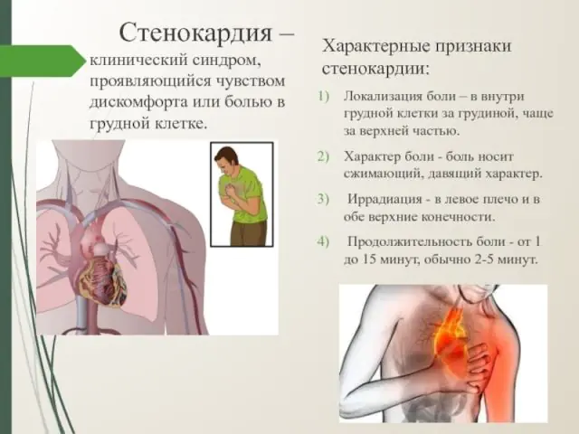 Symptomer på angina