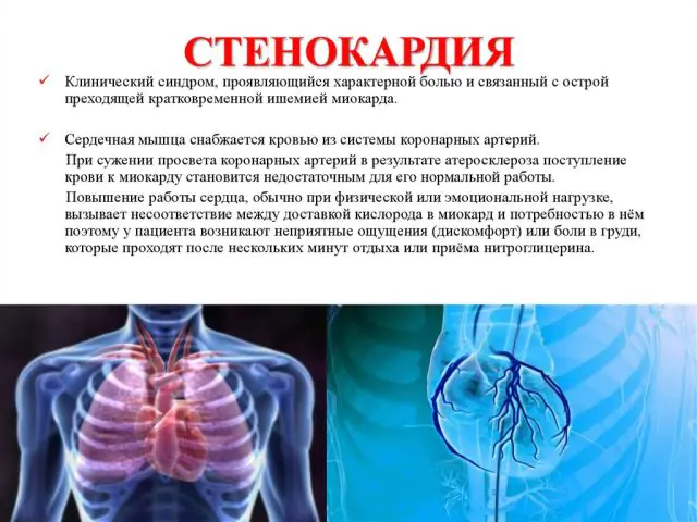 Beskrivelse af angina