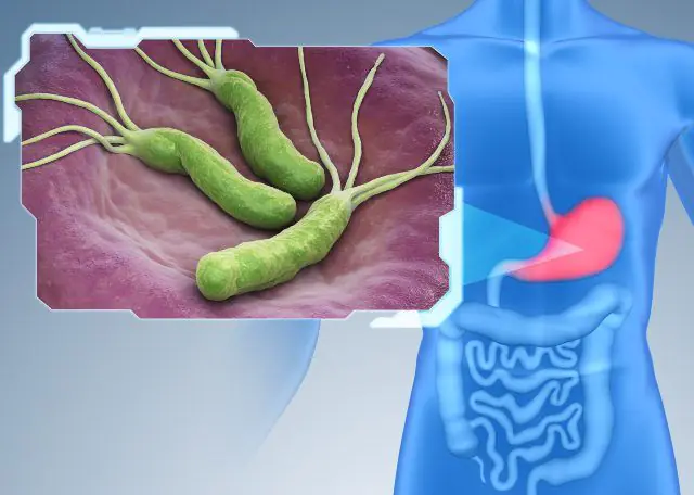 Helicobacter pylori as a cause of ulcerative gastritis