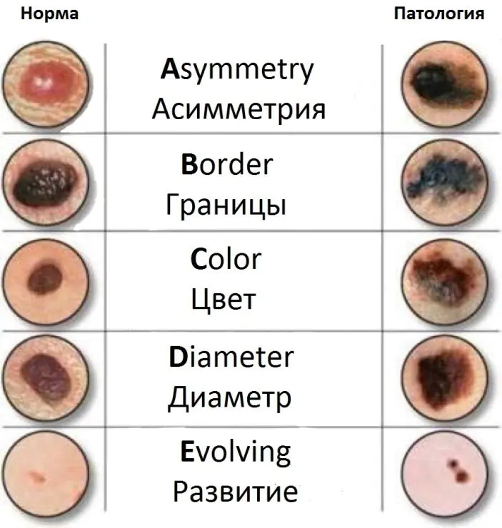 pochemu-cherneyut-rodinki-na-AgdwKxC.webp