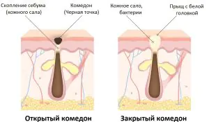 procedimiento-dlya-lica-ot-aezxkvJ.webp