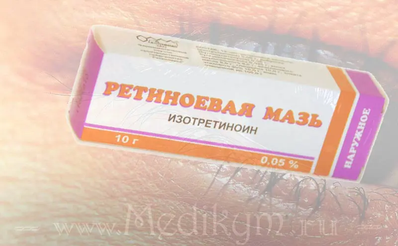 retinolo-protiv-morshin-NOxgR.webp