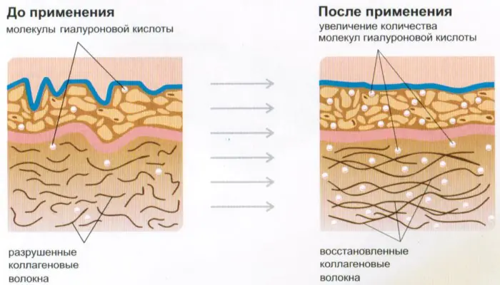 archivo-v-kosmetologii-chto-fHklh.webp