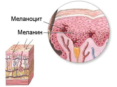 Removing red spots after acne