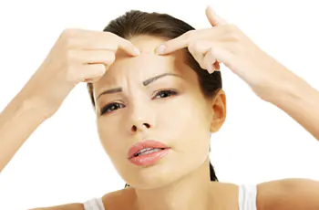 Oorzaken en behandeling van acne op het voorhoofd