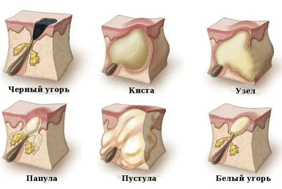 ugri-na-shee-u-zhenshin-BhwtRYB.webp