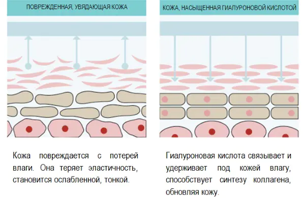 ukoly-gialuronovoj-kisloty-v-DlLAIxu.webp