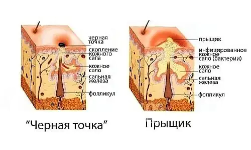 umenshenie-por-na-lice-v-szLZnuB.webp