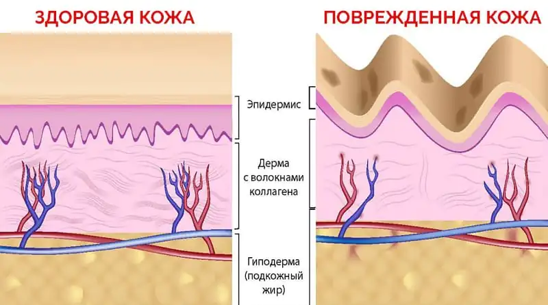 uprazhneniya-chtoby-ubrat-kOaCW.webp