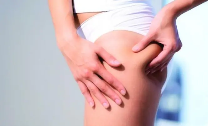 The benefits of cupping massage for cellulite