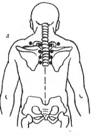 for pain in the upper back