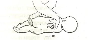 Reflex extension of the spine